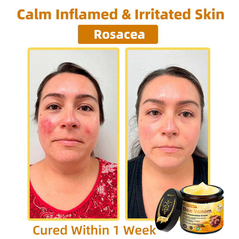 Mayo Clinic Official: Awzlove™ Powerful All-Body Skin Treatment Cream Anti-aging, Hydrating, Skin Repair, Even Tone, Acne and Dark Spot Treatment, Wart and Mole Removal, Psoriasis Relief (Suitable for all ages & AAD recommends) 💌