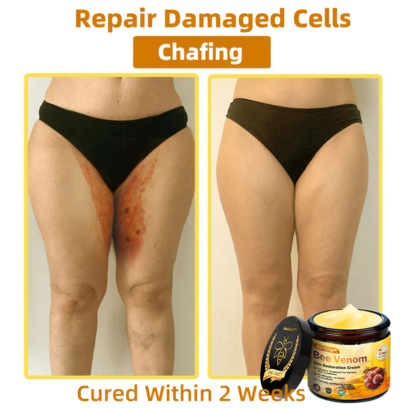 Mayo Clinic Official: Awzlove™ Powerful All-Body Skin Treatment Cream Anti-aging, Hydrating, Skin Repair, Even Tone, Acne and Dark Spot Treatment, Wart and Mole Removal, Psoriasis Relief (Suitable for all ages & AAD recommends) 💌
