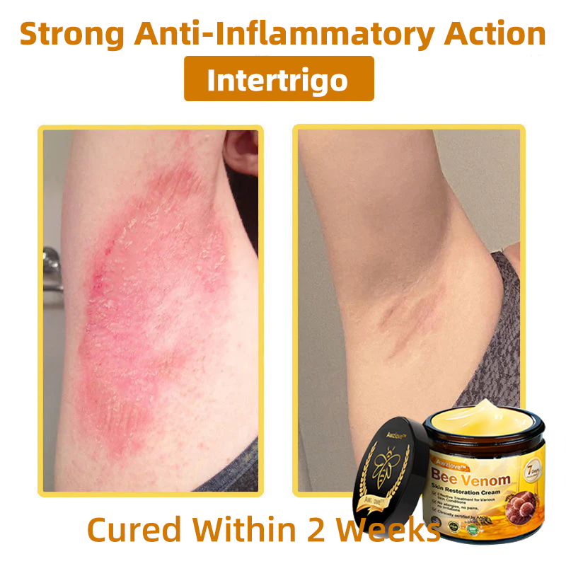 Mayo Clinic Official: Awzlove™ Powerful All-Body Skin Treatment Cream Anti-aging, Hydrating, Skin Repair, Even Tone, Acne and Dark Spot Treatment, Wart and Mole Removal, Psoriasis Relief (Suitable for all ages & AAD recommends) 💌