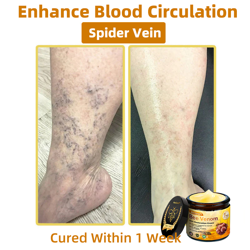 Mayo Clinic Official: Awzlove™ Powerful All-Body Skin Treatment Cream Anti-aging, Hydrating, Skin Repair, Even Tone, Acne and Dark Spot Treatment, Wart and Mole Removal, Psoriasis Relief (Suitable for all ages & AAD recommends) 💌