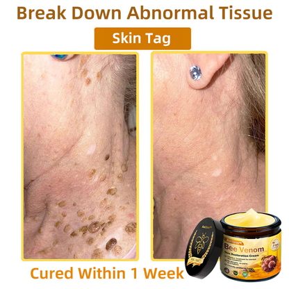 Mayo Clinic Official: Awzlove™  Powerful All-Body Skin Treatment Cream Anti-aging, Hydrating, Skin Repair, Even Tone, Acne and Dark Spot Treatment, Wart and Mole Removal, Psoriasis Relief (Suitable for all ages & AAD recommends) 💌