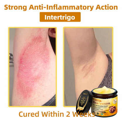 Mayo Clinic Official: Awzlove™  Powerful All-Body Skin Treatment Cream Anti-aging, Hydrating, Skin Repair, Even Tone, Acne and Dark Spot Treatment, Wart and Mole Removal, Psoriasis Relief (Suitable for all ages & AAD recommends) 💌